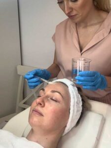 Nurse Kelsey Chemical Peel Treatment for a woman