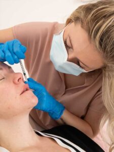 Dermal Lip Filler Treatment