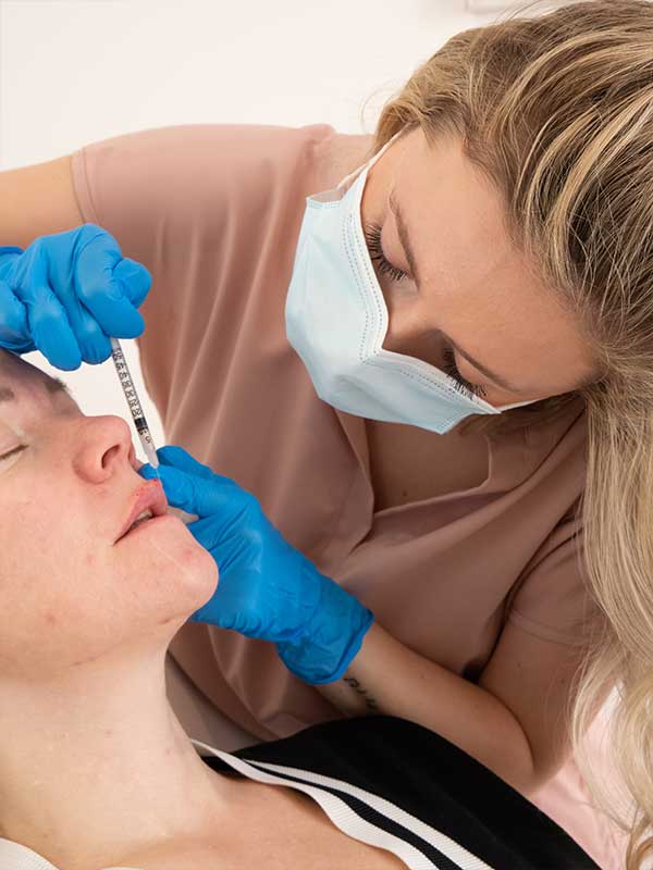 Dermal Lip Filler Treatment